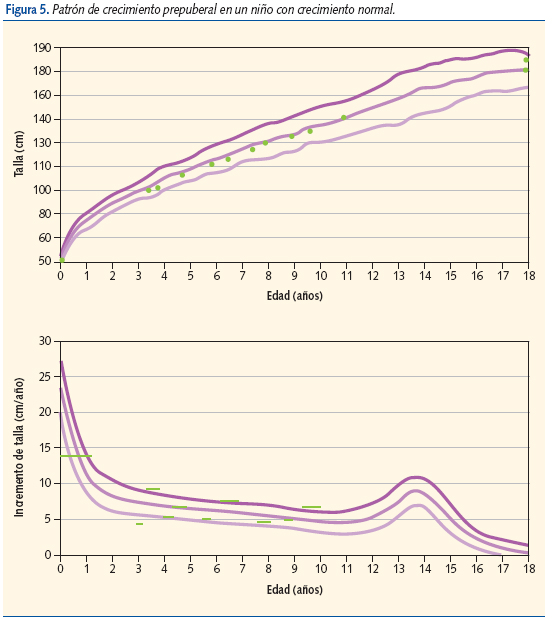 Figura 5. Patrón de crecimiento prepuberal en un niño con crecimiento normal.